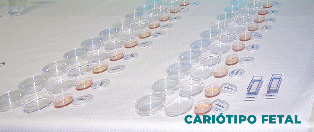 CARIÓTIPO FETAL.jpg
